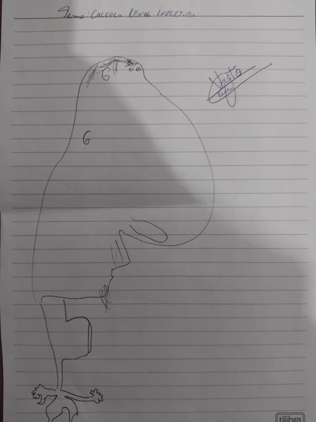 calculo renal invertido